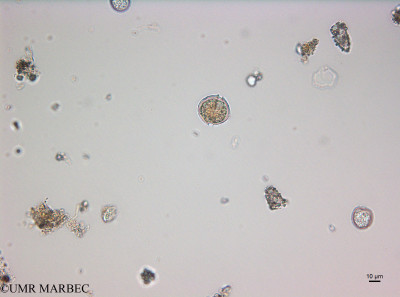 phyto/Thau_Lagoon/THAU_station1/OSU_plancton 2017/Alexandrium tamarense (200317_dino180525_001_ovl)(copy)_thumb.jpg